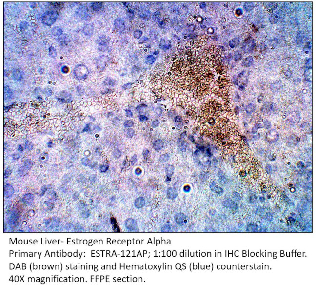 Estrogen Receptor alpha Antibody in Immunohistochemistry (IHC)