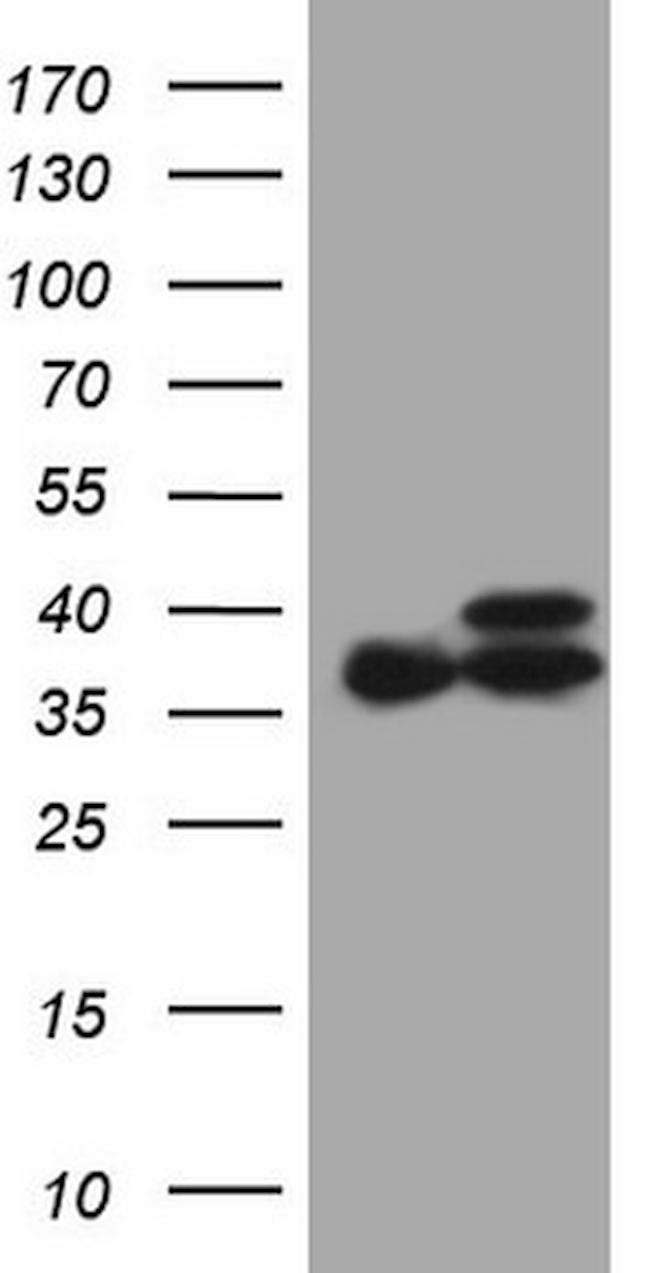 ETFA Antibody in Western Blot (WB)