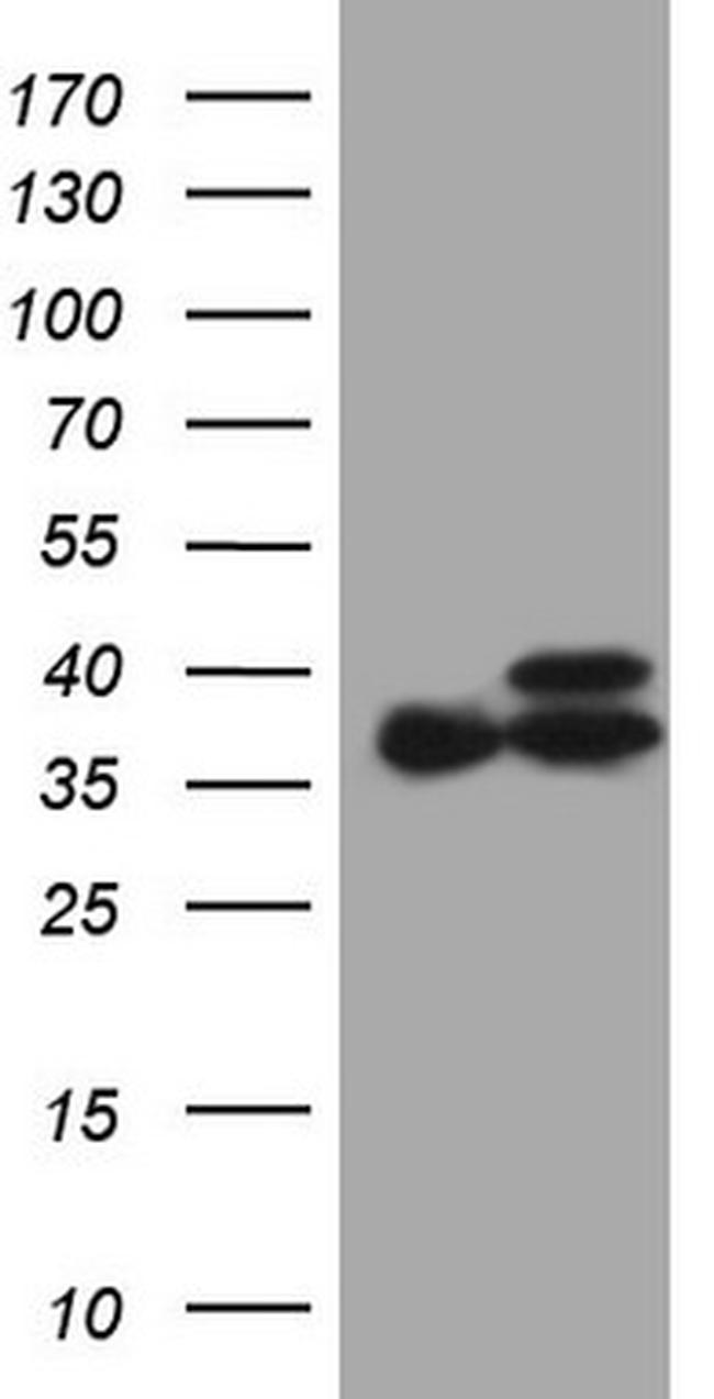 ETFA Antibody in Western Blot (WB)