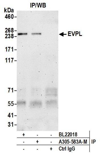 EVPL Antibody in Immunoprecipitation (IP)
