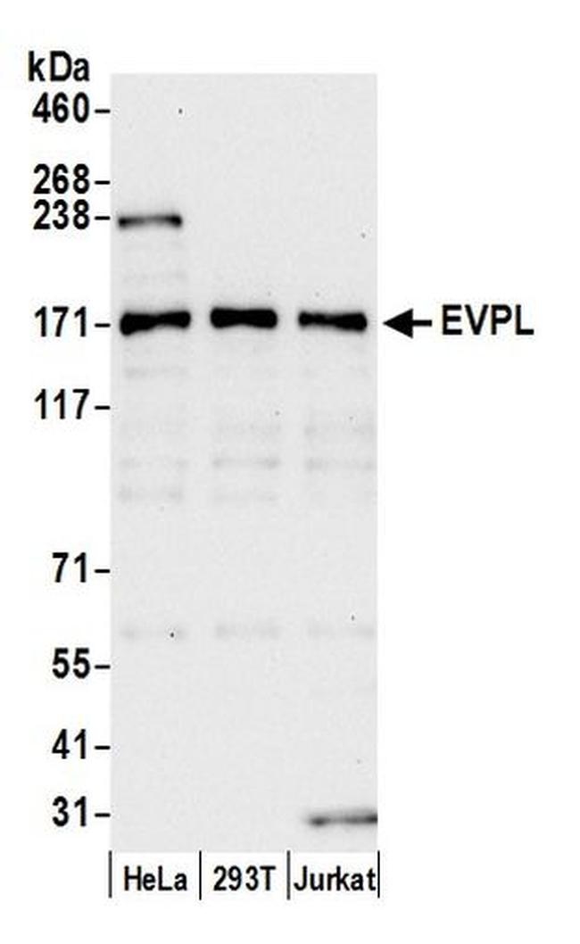 EVPL Polyclonal Antibody (A305582AT)