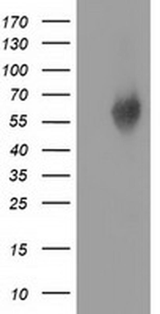EXD1 Antibody in Western Blot (WB)