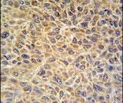 EXOC3L2 Antibody in Immunohistochemistry (IHC)