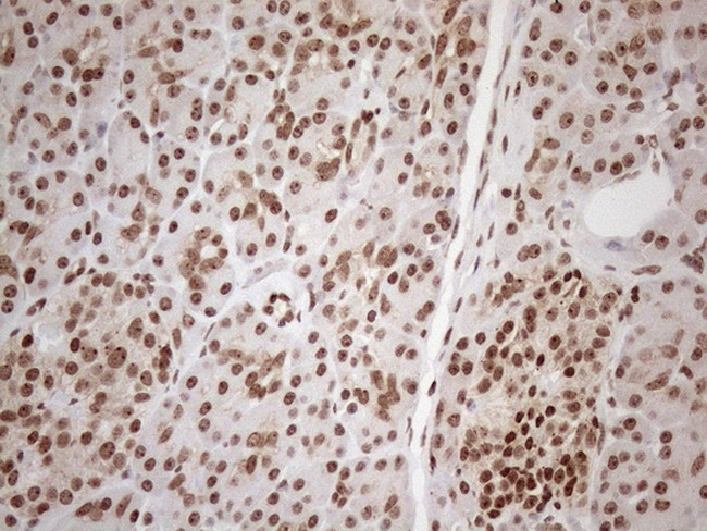 EXOSC1 Antibody in Immunohistochemistry (Paraffin) (IHC (P))