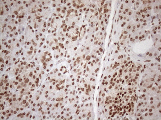 EXOSC1 Antibody in Immunohistochemistry (Paraffin) (IHC (P))