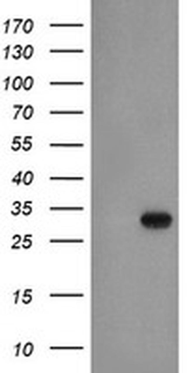 EXOSC3 Antibody in Western Blot (WB)
