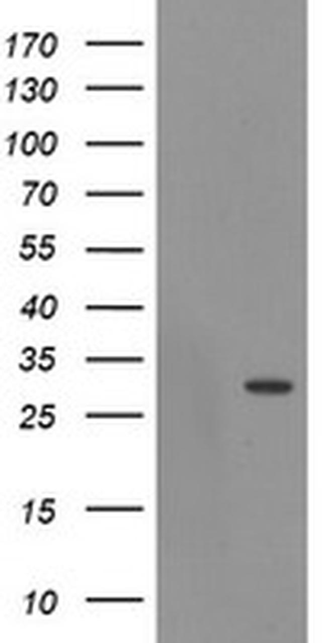 EXOSC3 Antibody in Western Blot (WB)