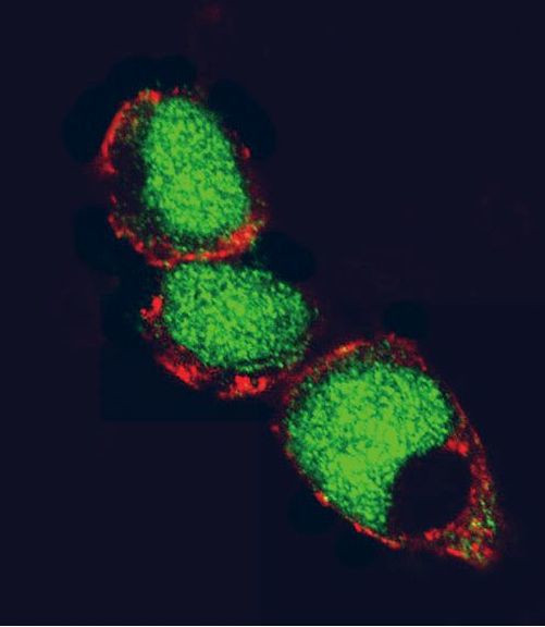 EZH2 Antibody in Immunocytochemistry (ICC/IF)
