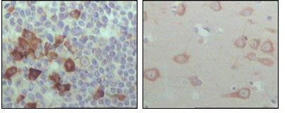 EphB6 Antibody in Immunohistochemistry (Paraffin) (IHC (P))