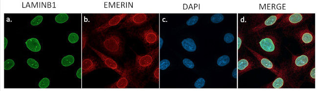 Emerin Antibody in Immunocytochemistry (ICC/IF)