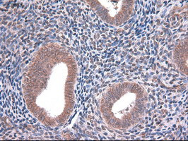 EpCAM Antibody in Immunohistochemistry (Paraffin) (IHC (P))