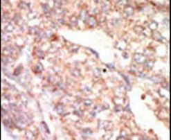 EphA1 Antibody in Immunohistochemistry (IHC)