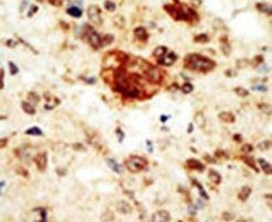 EphA1 Antibody in Immunohistochemistry (IHC)