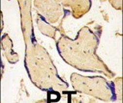 EphA3 Antibody in Immunohistochemistry (IHC)