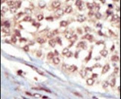 EphA5 Antibody in Immunohistochemistry (IHC)