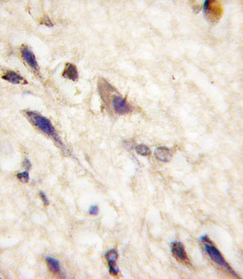 EphA5 Antibody in Immunohistochemistry (IHC)