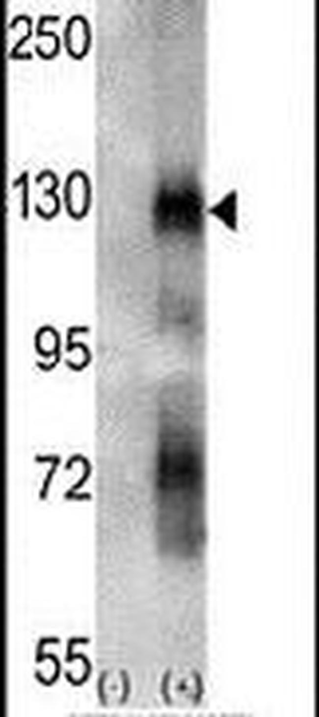 EphA6 Antibody in Western Blot (WB)