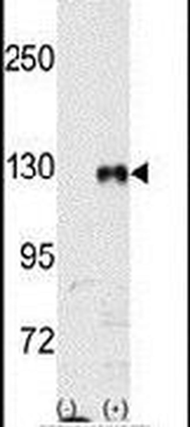 EphB1 Antibody in Western Blot (WB)