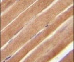 EphB2 Antibody in Immunohistochemistry (IHC)