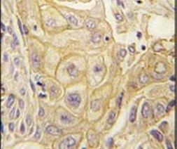 EphB2 Antibody in Immunohistochemistry (IHC)