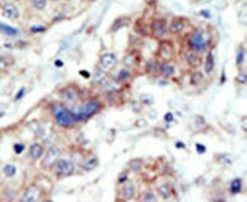 EphB3 Antibody in Immunohistochemistry (IHC)