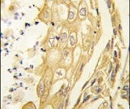 EphB4 Antibody in Immunohistochemistry (IHC)