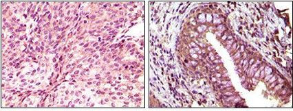 EphB6 Antibody in Immunohistochemistry (Paraffin) (IHC (P))