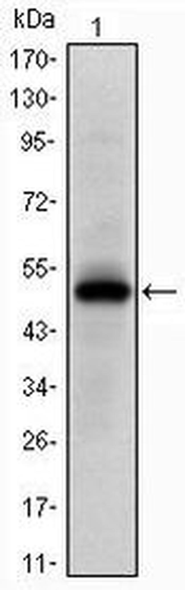 EphA10 Antibody in Western Blot (WB)
