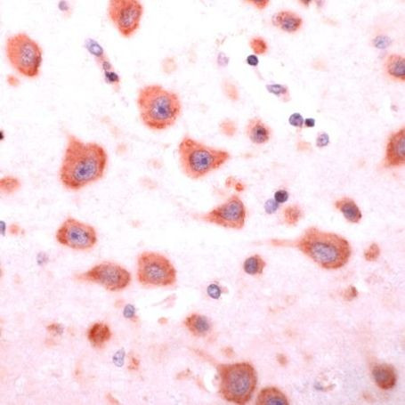 Ephrin A4 Antibody in Immunohistochemistry (IHC)