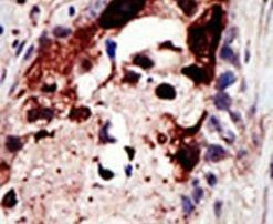 Epsin 2 Antibody in Immunohistochemistry (IHC)