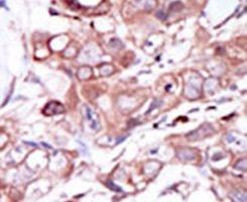 ErbB4 Antibody in Immunohistochemistry (IHC)