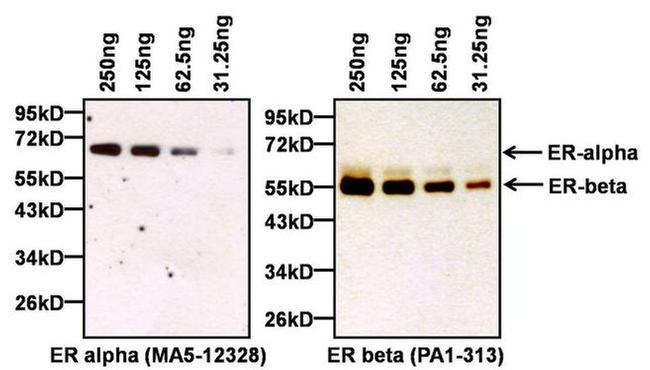 Estrogen Receptor alpha Antibody in Western Blot (WB)