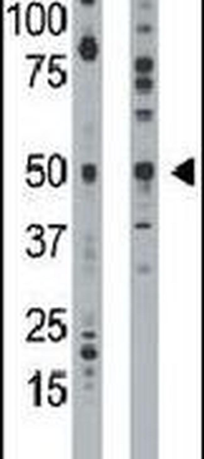 ETNK1 Antibody in Western Blot (WB)