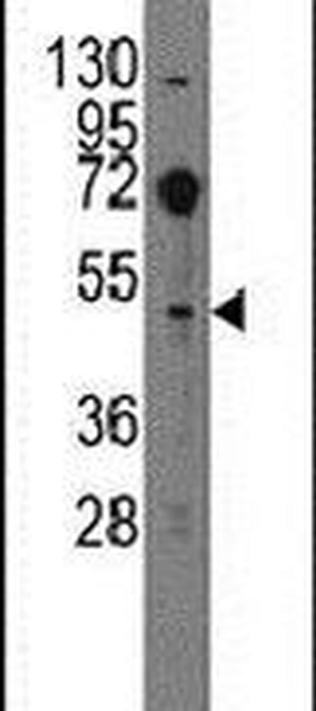 EVX2 Antibody in Western Blot (WB)