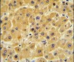 Factor X Antibody in Immunohistochemistry (IHC)