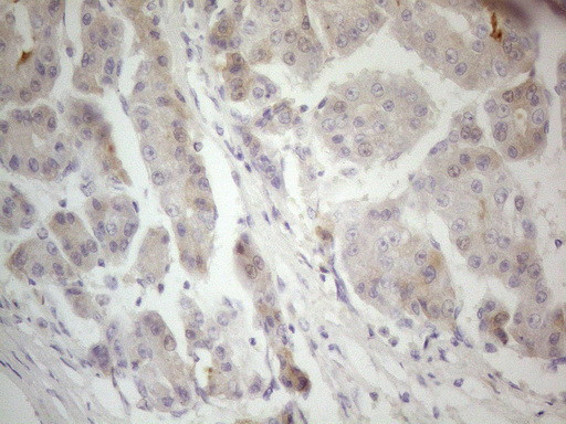 F12 Antibody in Immunohistochemistry (Paraffin) (IHC (P))