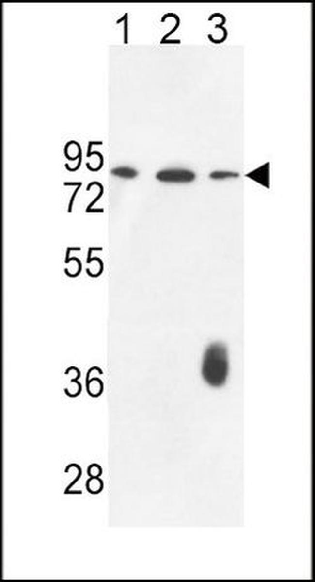 Factor XII Antibody in Western Blot (WB)