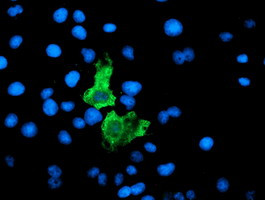 F13A1 Antibody in Immunocytochemistry (ICC/IF)