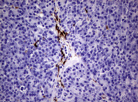 F13A1 Antibody in Immunohistochemistry (Paraffin) (IHC (P))