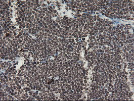 F13A1 Antibody in Immunohistochemistry (Paraffin) (IHC (P))