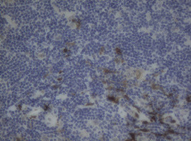 F13A1 Antibody in Immunohistochemistry (Paraffin) (IHC (P))
