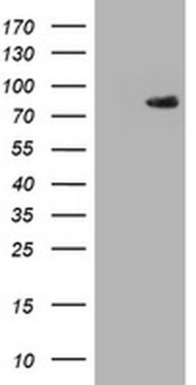 F13A1 Antibody in Western Blot (WB)