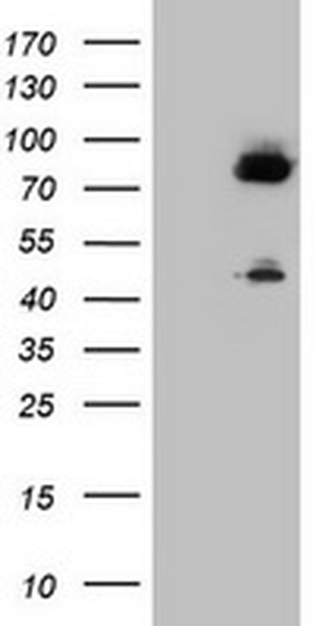 F13A1 Antibody in Western Blot (WB)