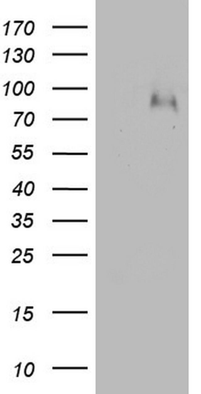 F13B Antibody in Western Blot (WB)