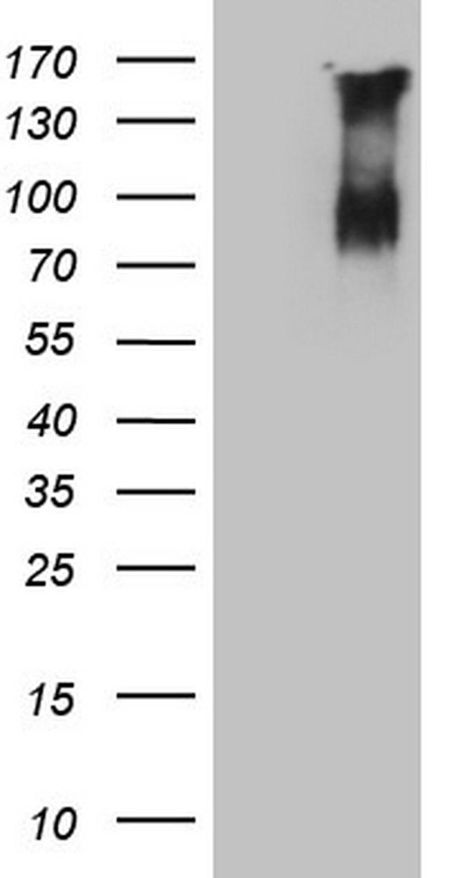 F13B Antibody in Western Blot (WB)