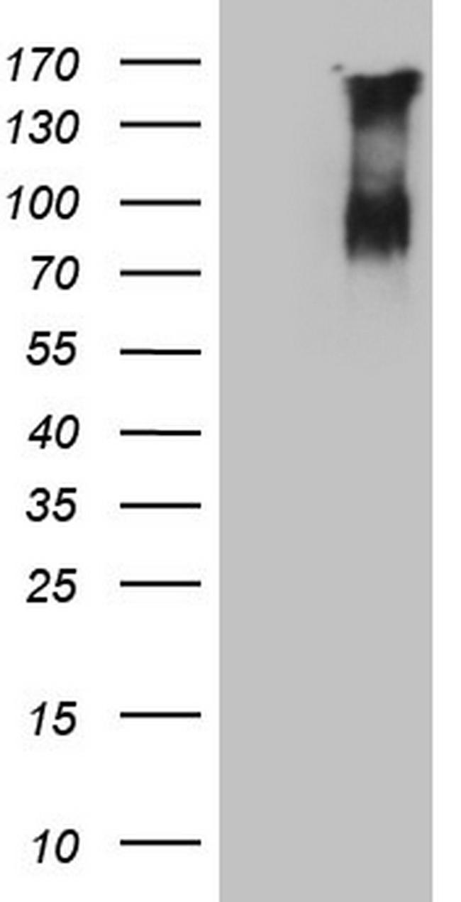 F13B Antibody in Western Blot (WB)