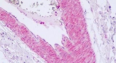 PAR2 Antibody in Immunohistochemistry (Paraffin) (IHC (P))