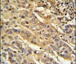 FAM91A1 Antibody in Immunohistochemistry (IHC)