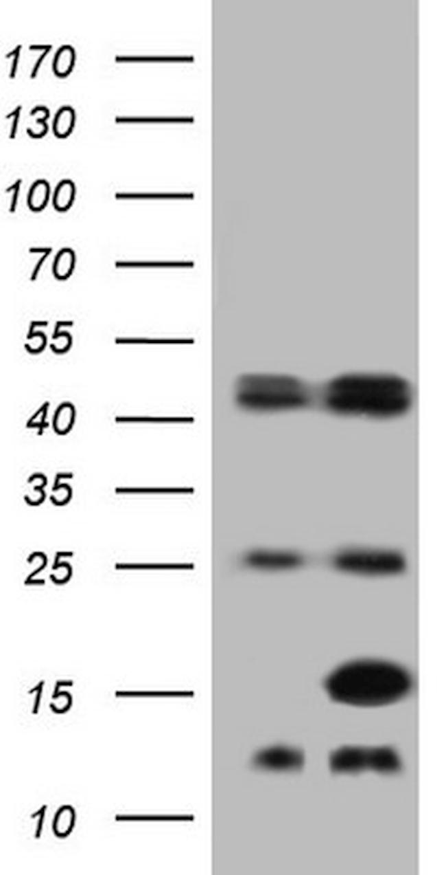 FABP5 Antibody in Western Blot (WB)