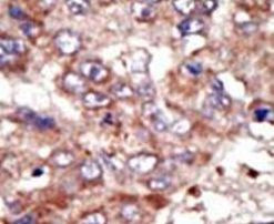 ACSL6 Antibody in Immunohistochemistry (IHC)